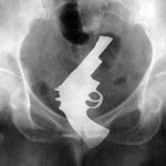 pistol-in-anus