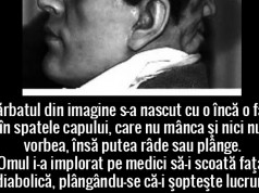 Edward Mordrake – omul cu două feţe omul cu doua fete