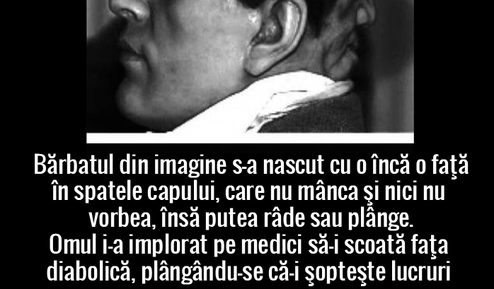 omul cu doua fete