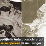 chirurg-operat-singur