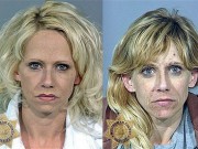 Transformări incredibile: înainte şi după droguri