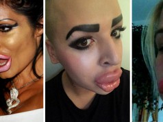 16 piţipoance care au vrut buze mari, dar arată ca nişte ventuze