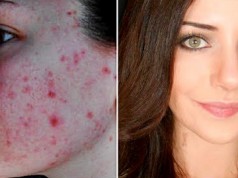 Un cretin a divorţat la o zi după nuntă şi-i cere daune femeii, după ce a văzut-o nemachiată