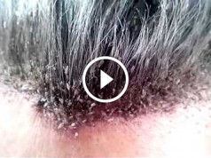 După ce vezi asta, te vei spăla pe cap de 3 ori pe zi (VIDEO)