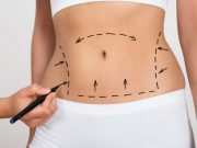 Harta durerilor abdominale. Spune unde te doare, ca să-ţi spun ce probleme ai harta durerilor abdominale