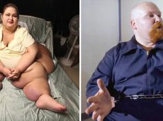 9 cazuri şocante, când oamenii au fost consideraţi prea graşi ca să…
