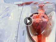 Acest dispozitiv uimitor ţine inimile „în viaţă”, până ajung la cei care au nevoie de ele