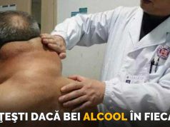 Timp de 30 de ani a băut câte un litru de alcool pe zi. Acum, bărbatul arată îngrozitor un litru de alcool pe zi