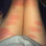 arsura prin blugi taiati8