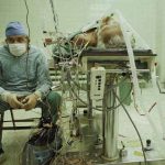 doctor-dupa-operatie-pe-inima