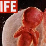 primul-fetus-fotografiat