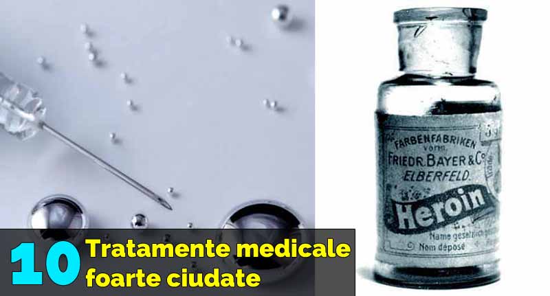 practici medicale ciudate