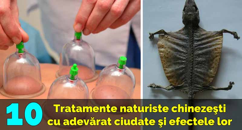 tratamente naturiste chinezesti