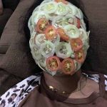 tratament-facial