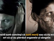 Sindromul Cotard – afecţiunea care te face să crezi că eşti mort sindromul codard