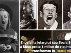 Boala somnului: a ucis 1 milion de oameni, iar supraviețuitorii devin statui vii boala somnului
