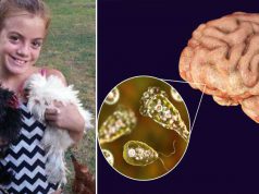 O amibă mâncătoare de creier a ucis o fetiţă de 10 ani, care înota într-un râu amibă mâncătoare de creier