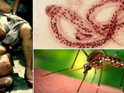 Viermele filarial – parazitul care te poate transforma în mutant viermele filarial