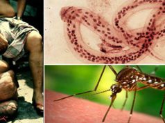 Viermele filarial – parazitul care te poate transforma în mutant viermele filarial