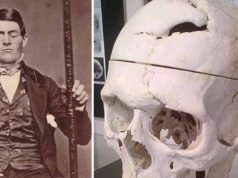 Cazul bizar al lui Phineas Gage, omul care a trăit cu o gaură în creier Phineas Gage