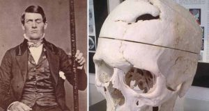 Phineas Gage