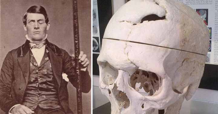 Phineas Gage