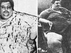 Jon Brower Minnoch, cel mai gras om din istorie, care a slăbit 419 kilograme cel mai gras om