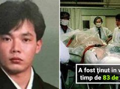 Hisashi Ouchi, cel mai radioactiv om din istorie, ţinut în viaţă timp de 83 de zile Hisashi Ouchi