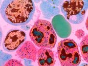 Câte celule există în organismul uman? Numărul este de-a dreptul ameţitor câte celule există în organismul uman