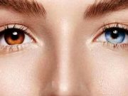 Heterocromia: de ce unii oameni au un ochi de o culoare şi unul de altă culoare heterocromia