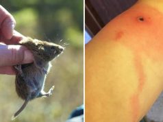 Ce este Alaskapox şi ce se cunoaşte despre acest virus care a început să facă victime în rândul oamenilor ce este alaskapox