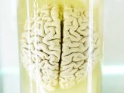 Timp de 5 ore, creierul unui porc a fost ţinut în viaţă în afara corpului, iar acest lucru ar putea fi de folos pentru oameni creierul unui porc a fost ţinut în viaţă