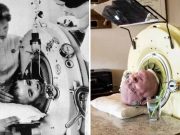 Paul Alexander, omul care a trăit 70 de ani într-un „plămân de fier”, a murit paul alexander plămân de fier