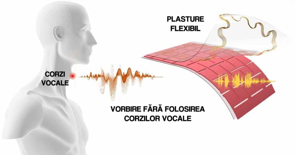 afecțiuni ale vocii plasture