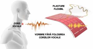 afecțiuni ale vocii plasture