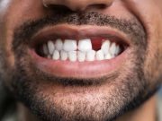 Medicamentul pentru regenerarea dinților va fi testat pentru prima dată pe oameni regenerarea dinților