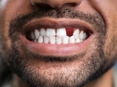 Medicamentul pentru regenerarea dinților va fi testat pentru prima dată pe oameni regenerarea dinților