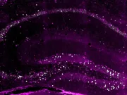 Creierul stochează cel puțin 3 copii ale fiecărei amintiri, arată un nou studiu Creierul stochează cel puțin 3 copii ale fiecărei amintiri