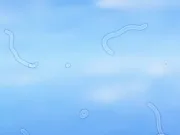 Ce sunt formele ciudate pe care le vezi în faţa ochilor atunci când te uiţi la cer: Muscae volitantes formele ciudate pe care le vezi