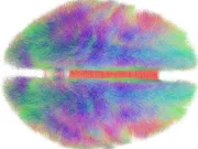 Putem trăi veșnic? Cum ar putea digitalizarea creierului să ne păstreze pe termen nelimitat trăi veșnic