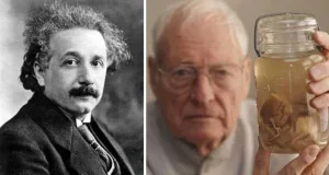 creierul lui Albert Einstein