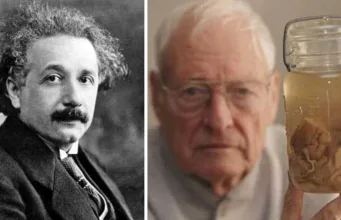 creierul lui Albert Einstein