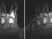 Ce este sunetul oribil care se aude când îți pocnești degetele? pocnești degetele