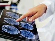 Oamenii de știință au descoperit motivul genetic pentru care creierul femeilor îmbătrânește diferit de cel al bărbaților creierul femeilor