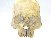 Istoria rescrisă: oase vechi de 4.000 de ani dezvăluie că lepra exista în America cu mult înaintea lui Columb lepra exista în America