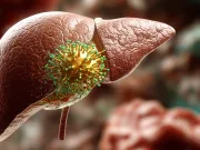 Cazurile de cancer hepatic s-ar putea dubla până în 2050. Iată 3 obiceiuri comune care îți pot crește exponențial riscul Cancerul hepatic, o epidemie anunțată pentru 2050