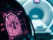 Îmbătrânești mai repede decât crezi? Oamenii de știință pot oferi răspunsul cu o singură scanare Îmbătrânești mai repede