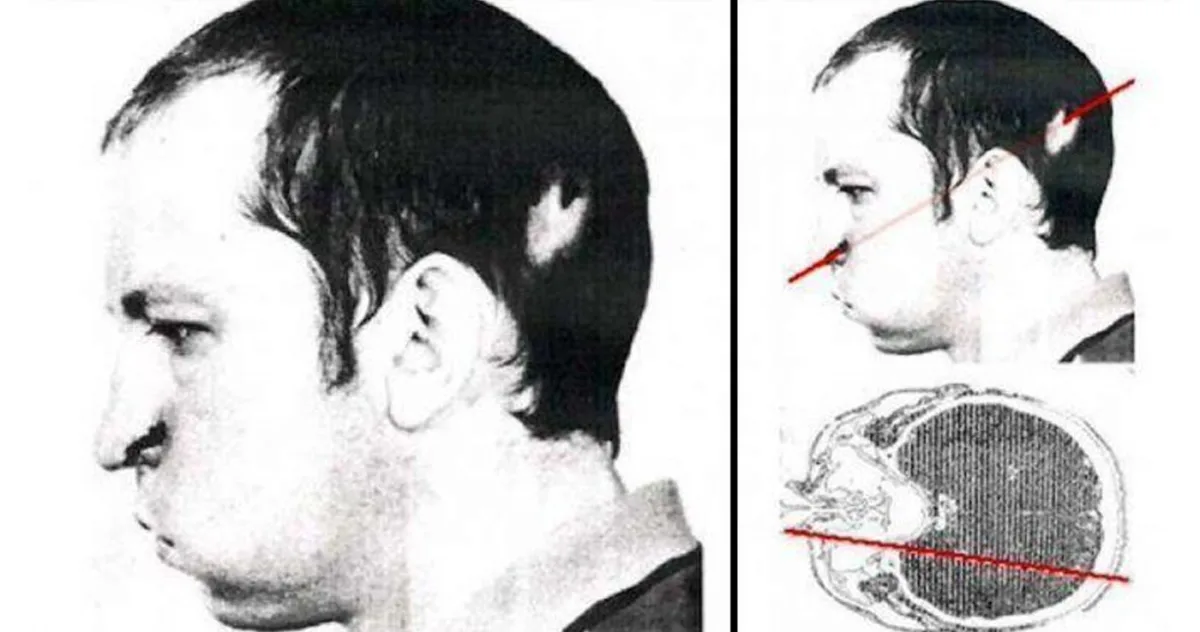 Ce s-a întâmplat cu singurul om lovit în cap de un accelerator de particule? Povestea savantului Anatoli Bugorski pare ireală