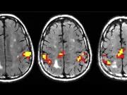 O parte surprinzătoare a creierului tău devine mai puternică pe măsură ce îmbătrânești O parte surprinzătoare a creierului tău devine mai puternică pe măsură ce îmbătrânești