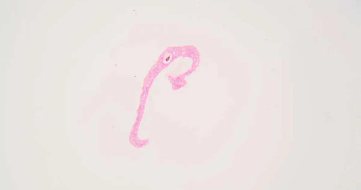 parazit oprește durerea